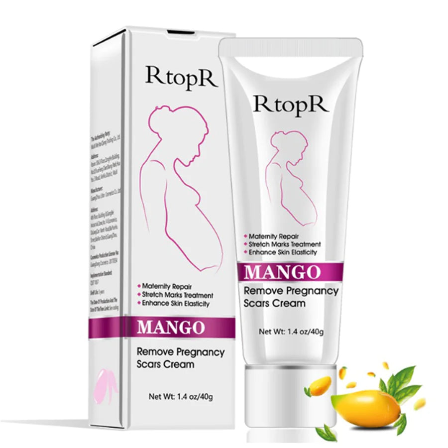 Mango Antenatal Cream - RtopR Body Cream