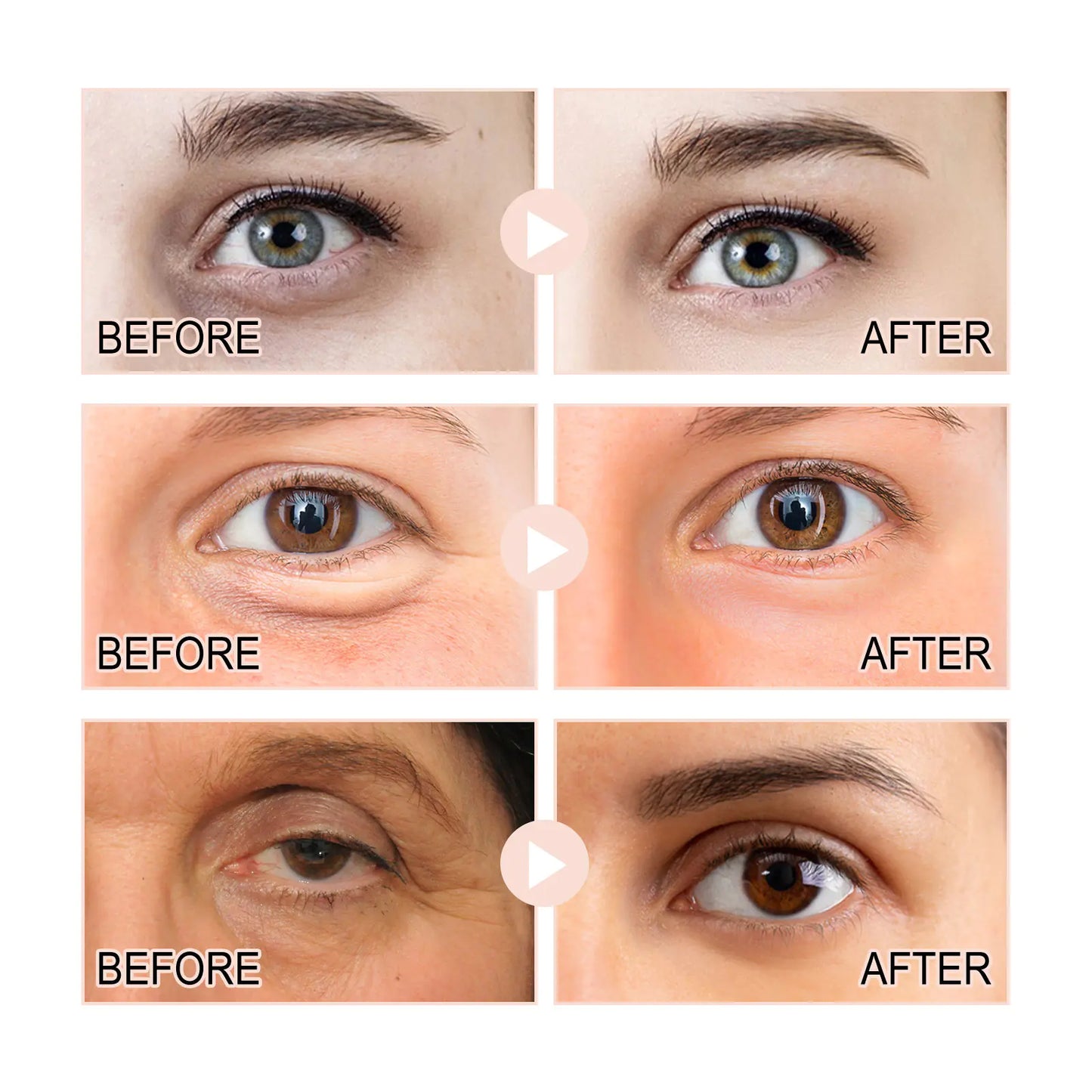 Retinol Eye Corner Fine Lines